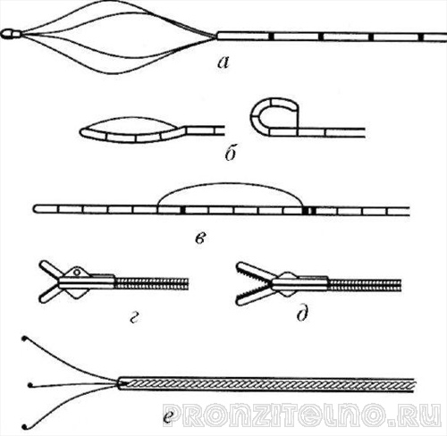 Инструменты для уретеролитоэкстракции: а - корзинка Дормиа; б - петля Цейса; в - петля Девиса; г - биопсийные щипцы; д - щипцы «аллигатор»; е - зажим «птичья лапа»